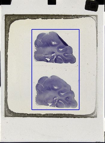 Media type: image; Special Collections 3043   shows specimen_part histological serial section;